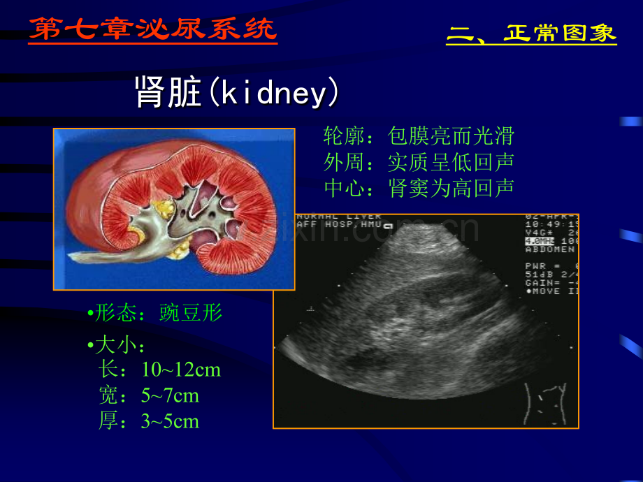 泌尿系统超声图像.ppt_第3页