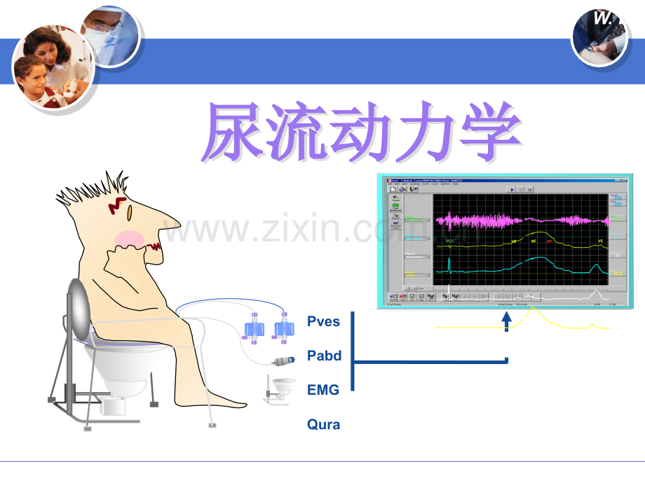 尿流动力学在前列腺增生中的应用.ppt_第2页