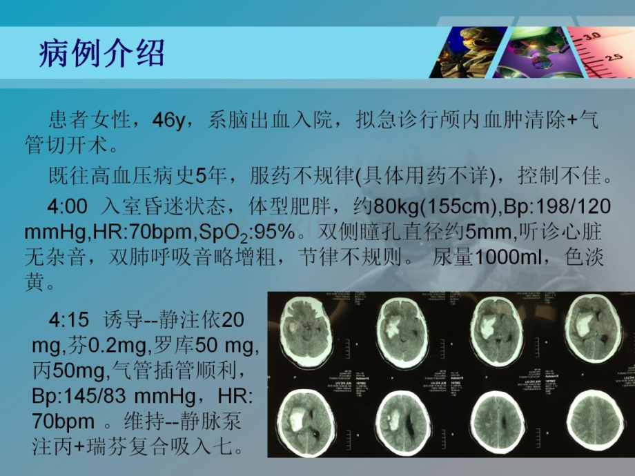 高血压性脑出血的麻醉管理.pptx_第2页