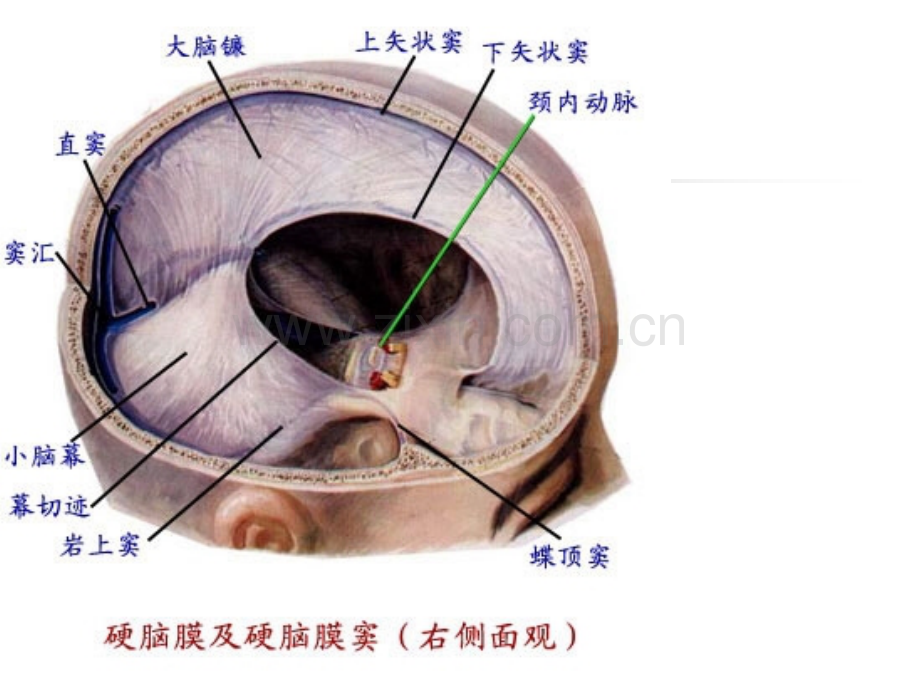 中枢神经系统影像诊断1.ppt_第3页