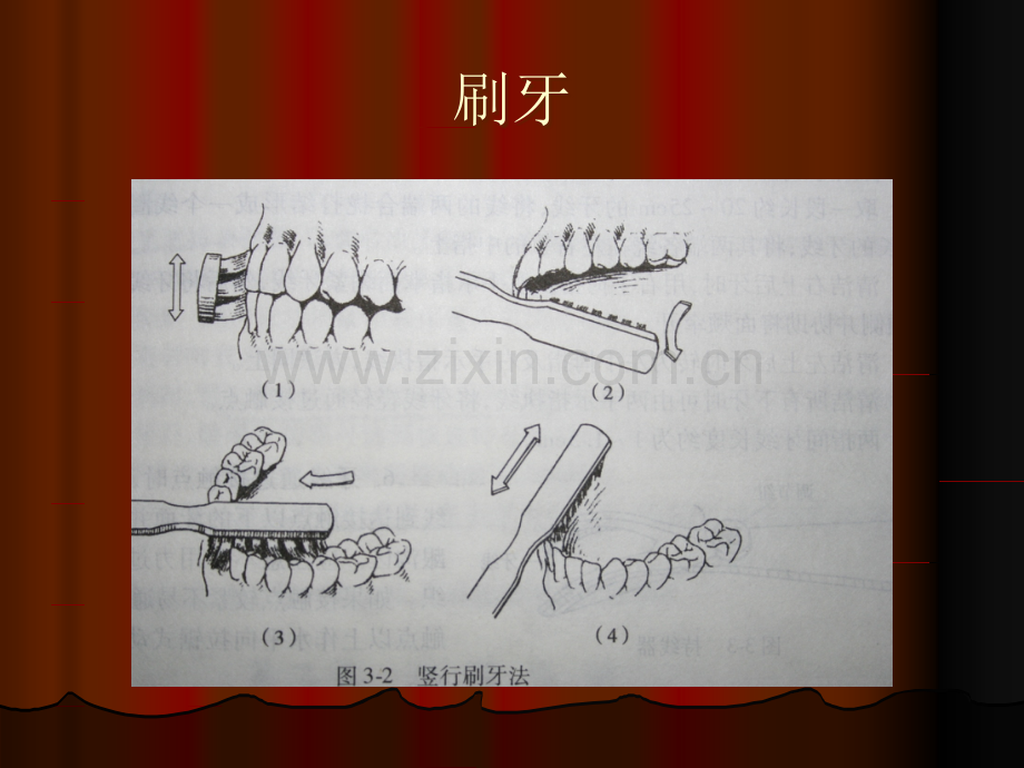 口腔医学第三章-口腔卫生保健粘膜病PPT课件.ppt_第3页