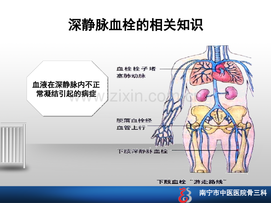 深静脉血栓的护理查房.ppt_第2页