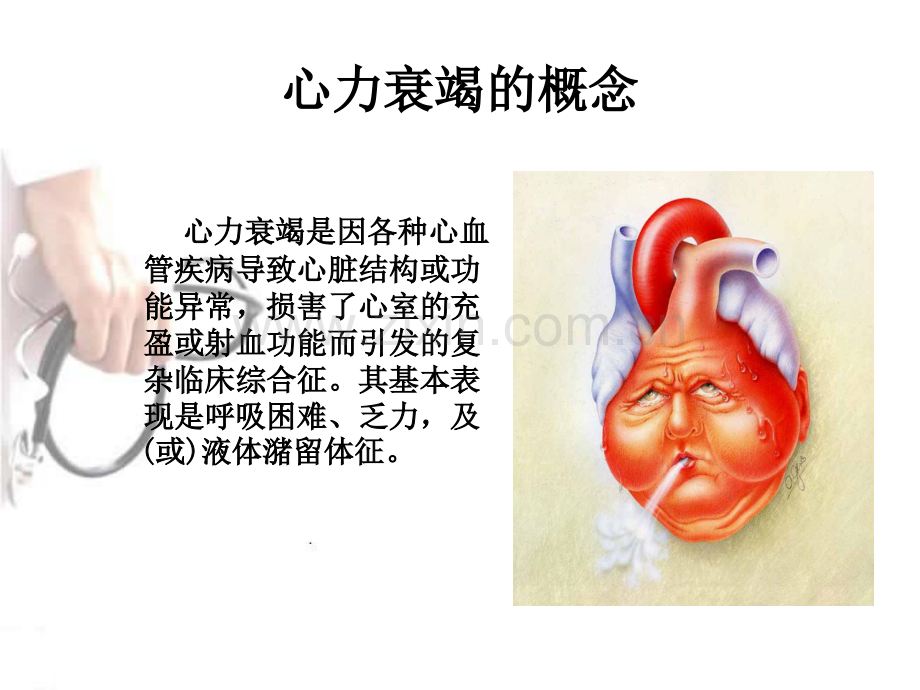 心衰病人的观察与护理.ppt_第2页