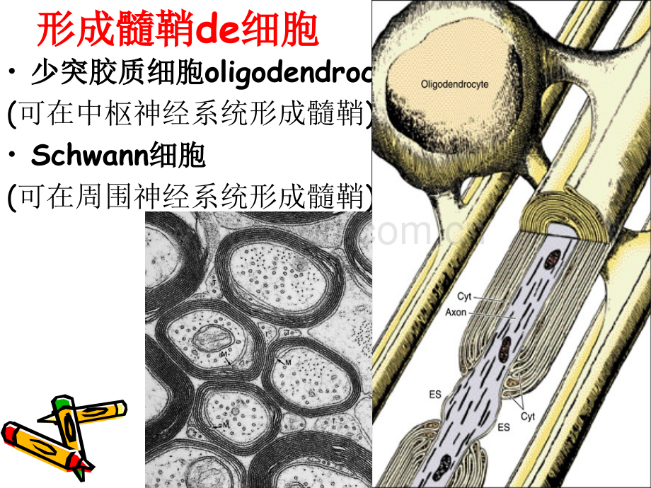 中枢神经系统脱髓鞘疾病-2.ppt_第3页