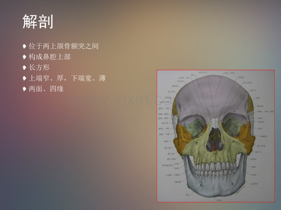 鼻骨骨折影像学诊断与鉴别.ppt_第2页