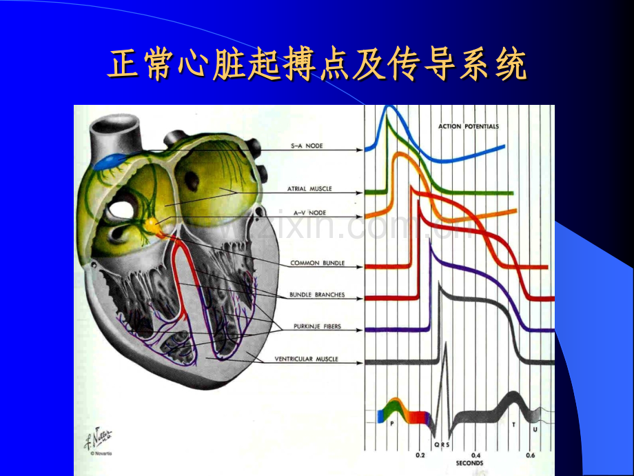 心律失常的诊断治疗PPT课件.ppt_第3页