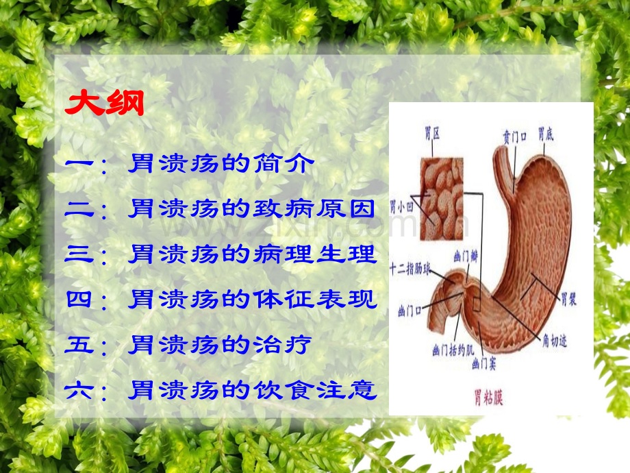 胃溃疡的形成机制及治疗.ppt_第2页