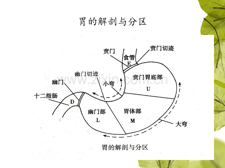 胃大部切除手术配合.ppt_第3页