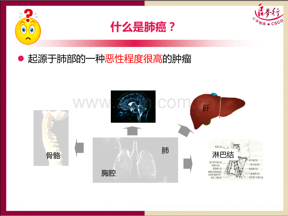 肺癌基础知识.ppt_第2页