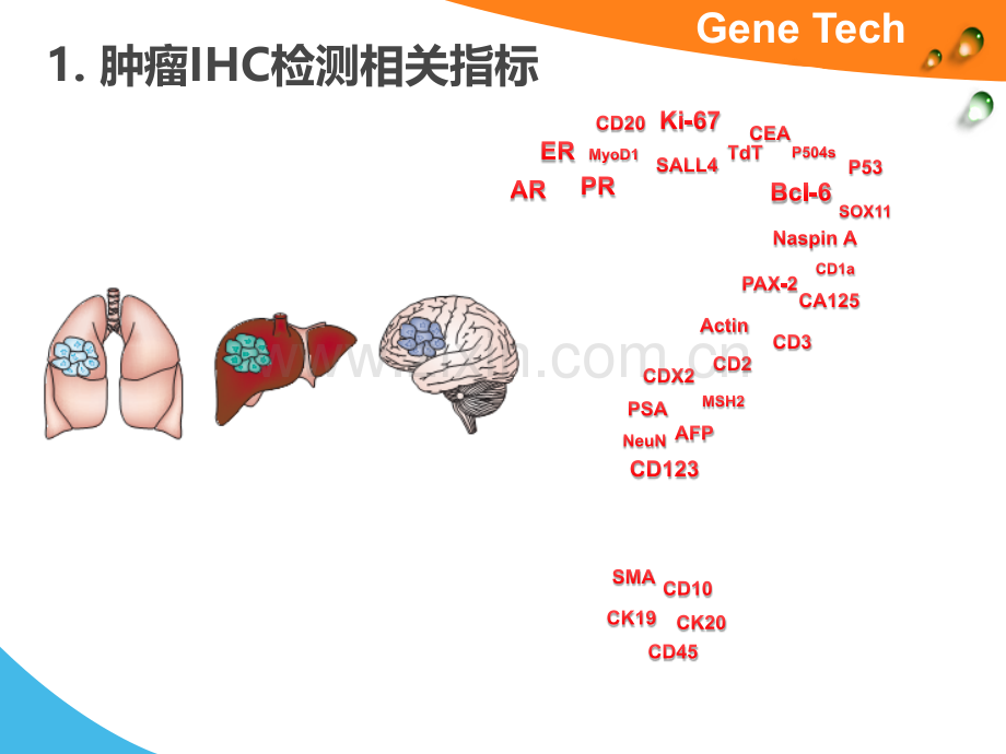 肿瘤ihc检测相关指标淋巴造血系统疾病.pptx_第2页