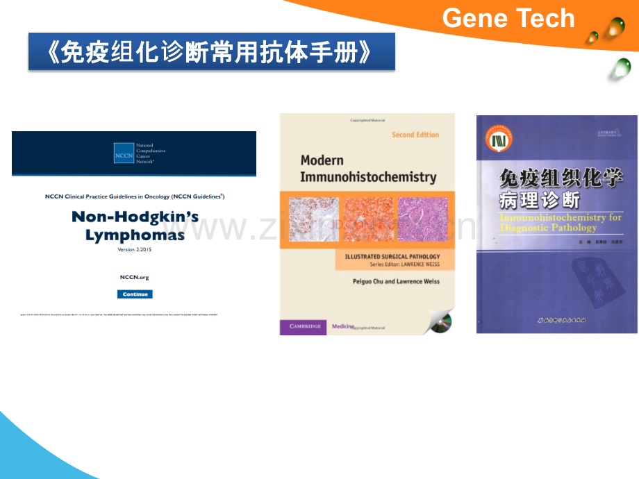 肿瘤ihc检测相关指标淋巴造血系统疾病.pptx_第3页