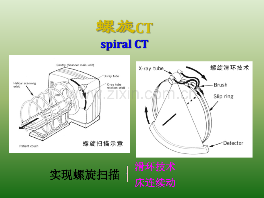 医学影像读片指南-PPT课件.ppt_第3页