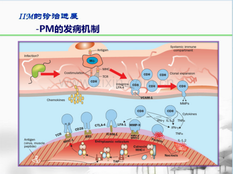 炎性肌病的诊断和治疗.pptx_第3页