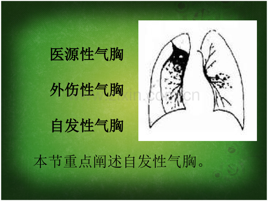 气胸病人的护理-(4)课件PPT课件.ppt_第3页