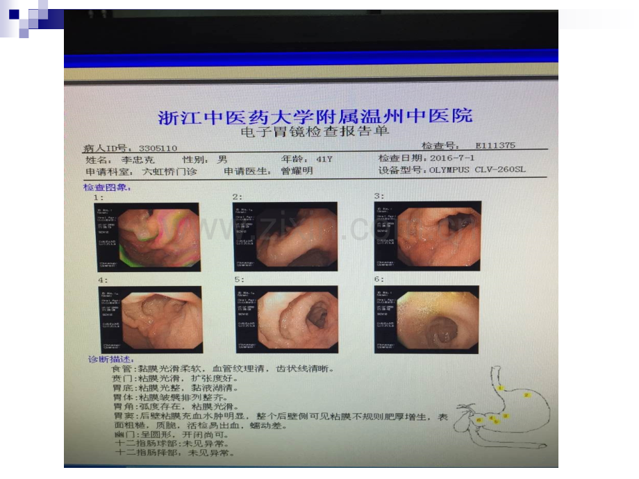 调理你的脾胃.ppt_第2页