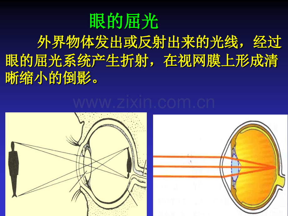 屈光不正与老视.ppt_第2页