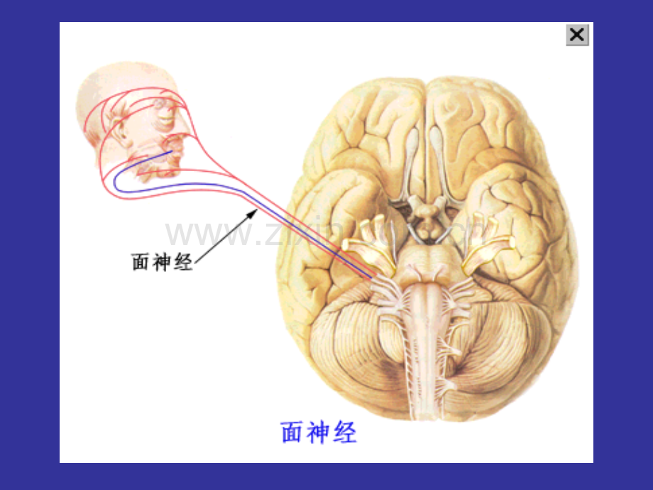 面神经麻痹第三次用.ppt_第3页