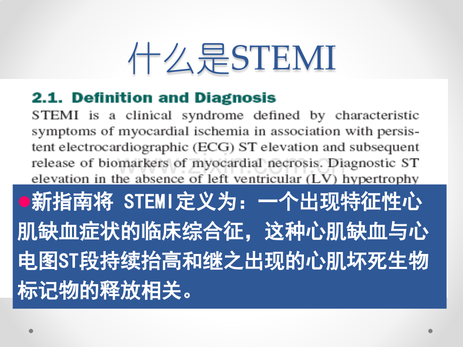 急诊内stemi.pptx_第2页