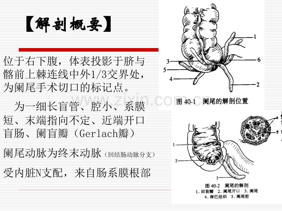 急性阑尾炎及护理.pptx_第3页