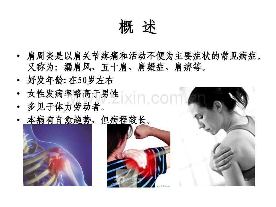 肩周炎的护理PPT课件.ppt_第2页