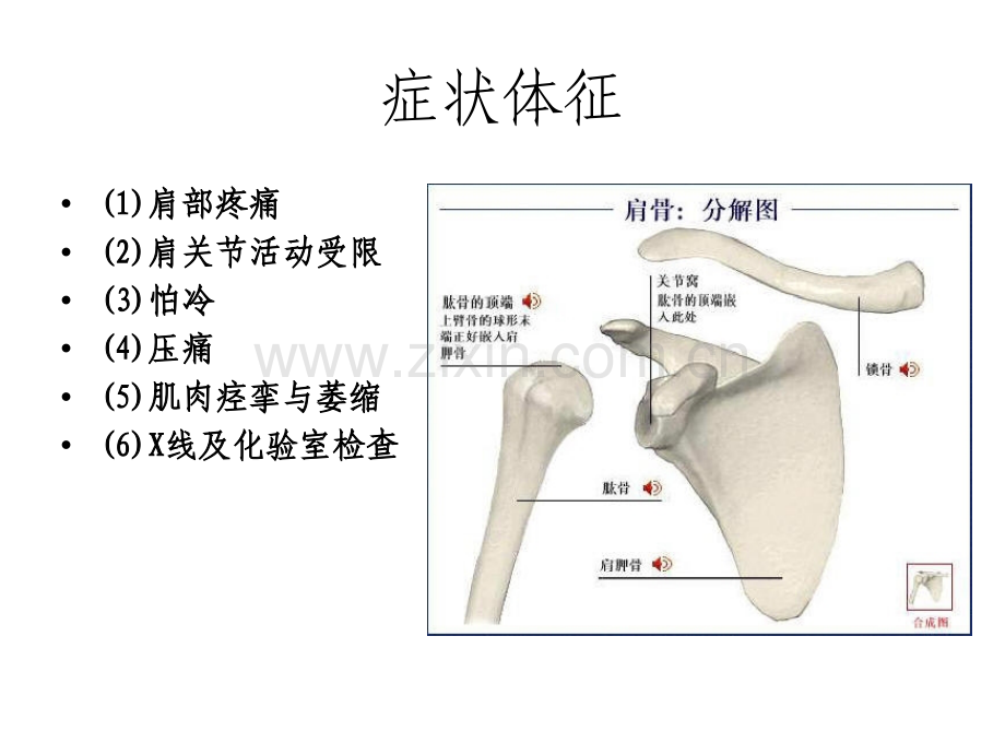 肩周炎的护理PPT课件.ppt_第3页