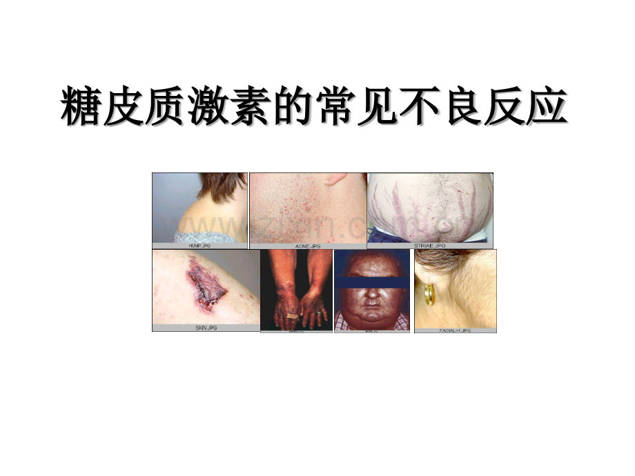 常用药物不良反应.ppt_第3页