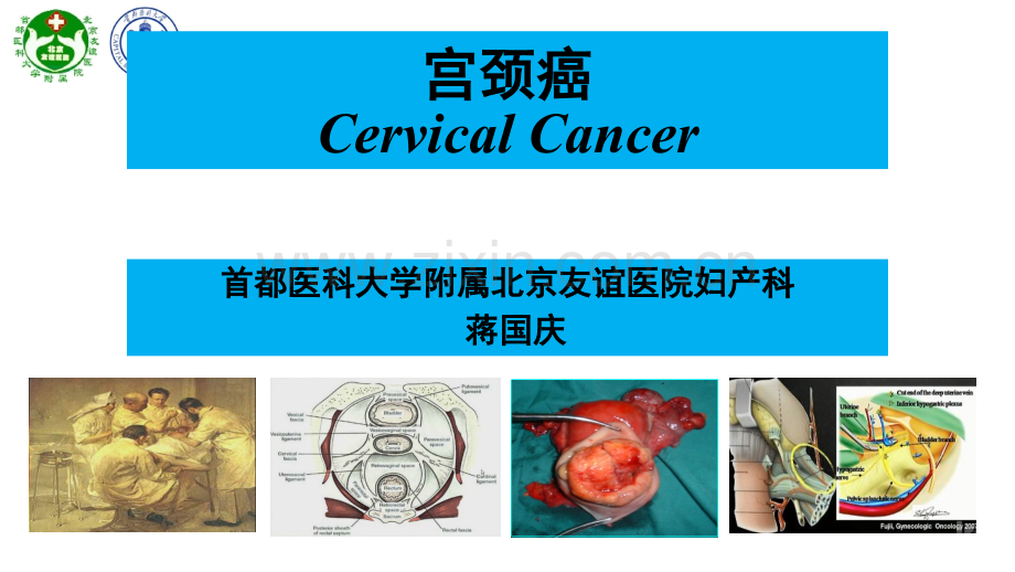 培训资料-宫颈癌(五年制与七年制学生课件).ppt_第3页