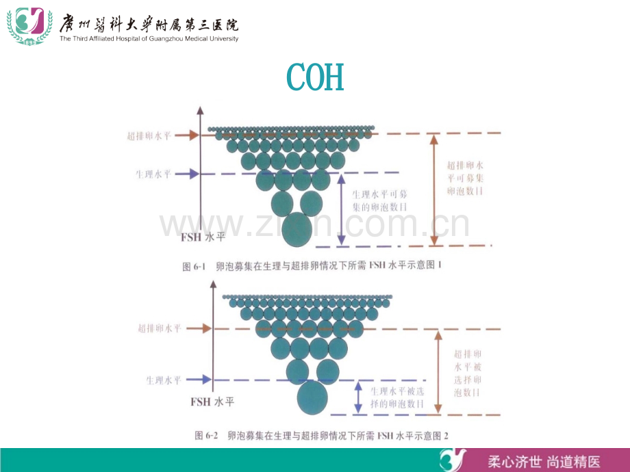 常见art方案.ppt_第3页