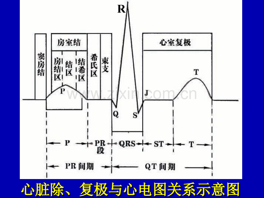 异常心电图的识别和处理.ppt_第3页