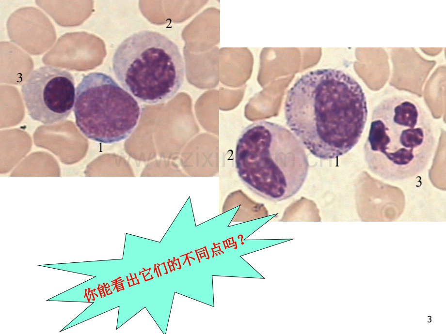 血液学检验-微型课--吴芹.ppt_第3页