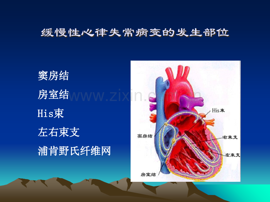 缓慢性心律失常的诊断及治疗.ppt_第3页