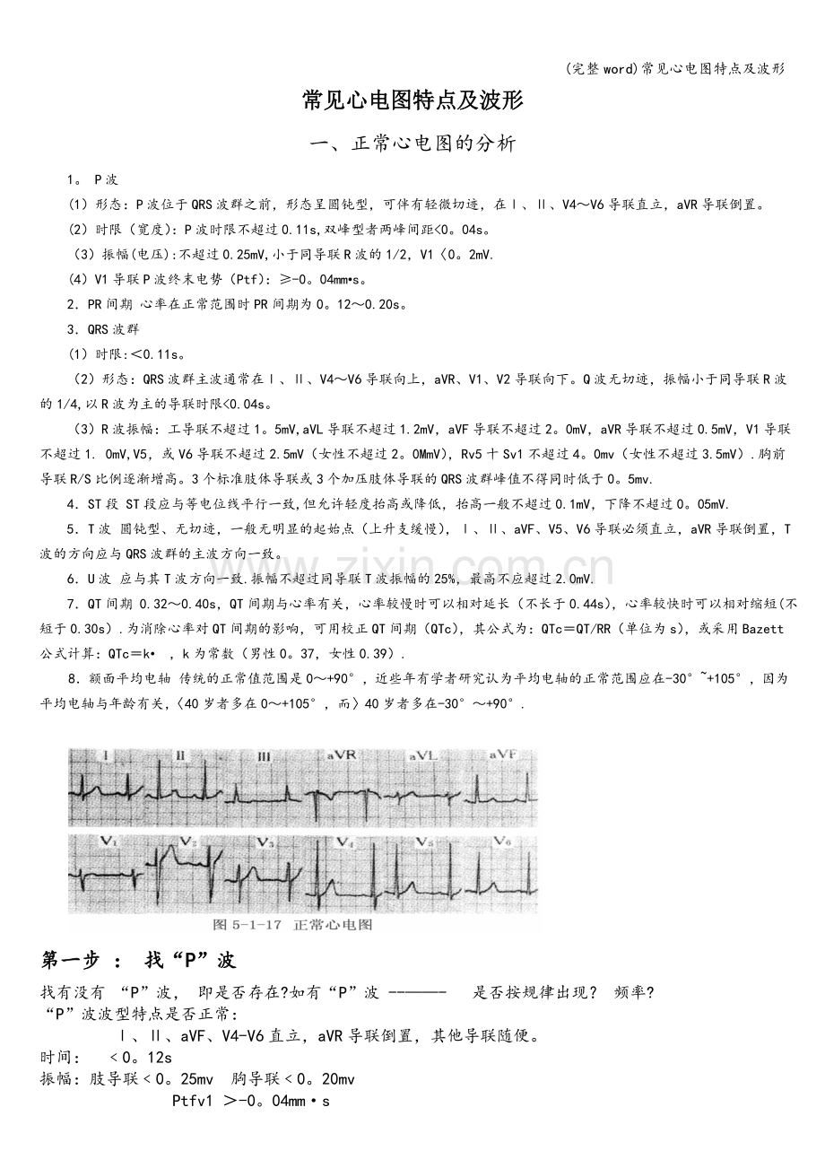 常见心电图特点及波形.doc_第2页