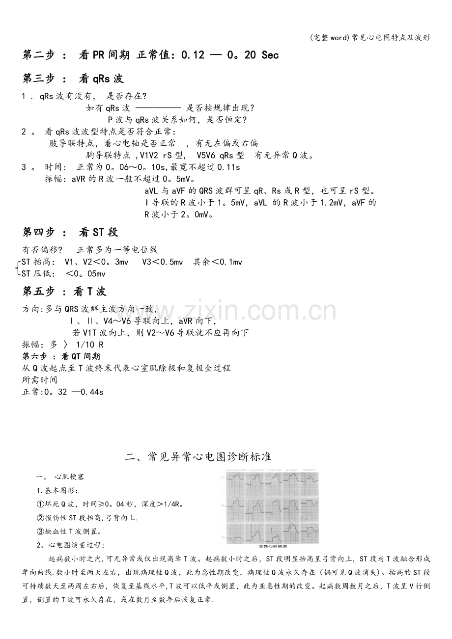 常见心电图特点及波形.doc_第3页