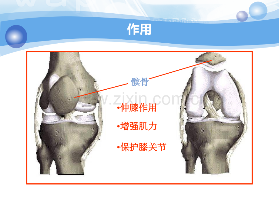 髌骨骨折护理查房医学PPT课件.ppt_第3页