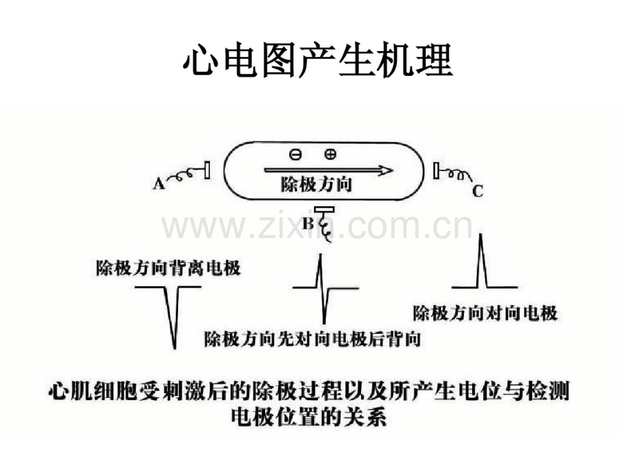 围术期常见的异常心电图分析.pdf_第2页