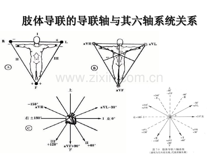 围术期常见的异常心电图分析.pdf_第3页