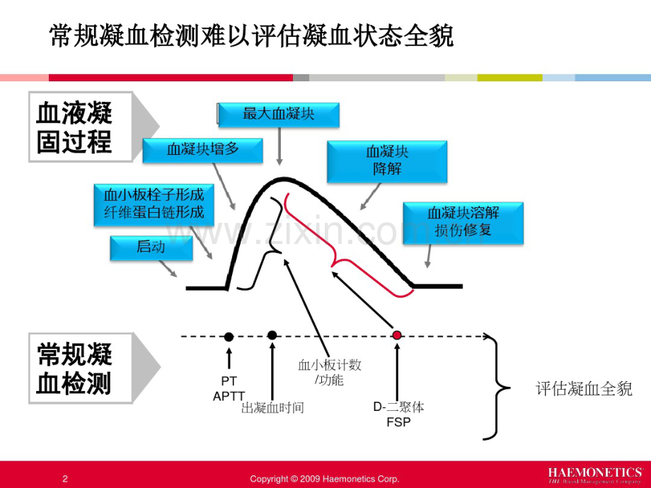 TEG血栓弹力图在骨科围术期的应用.pdf_第2页