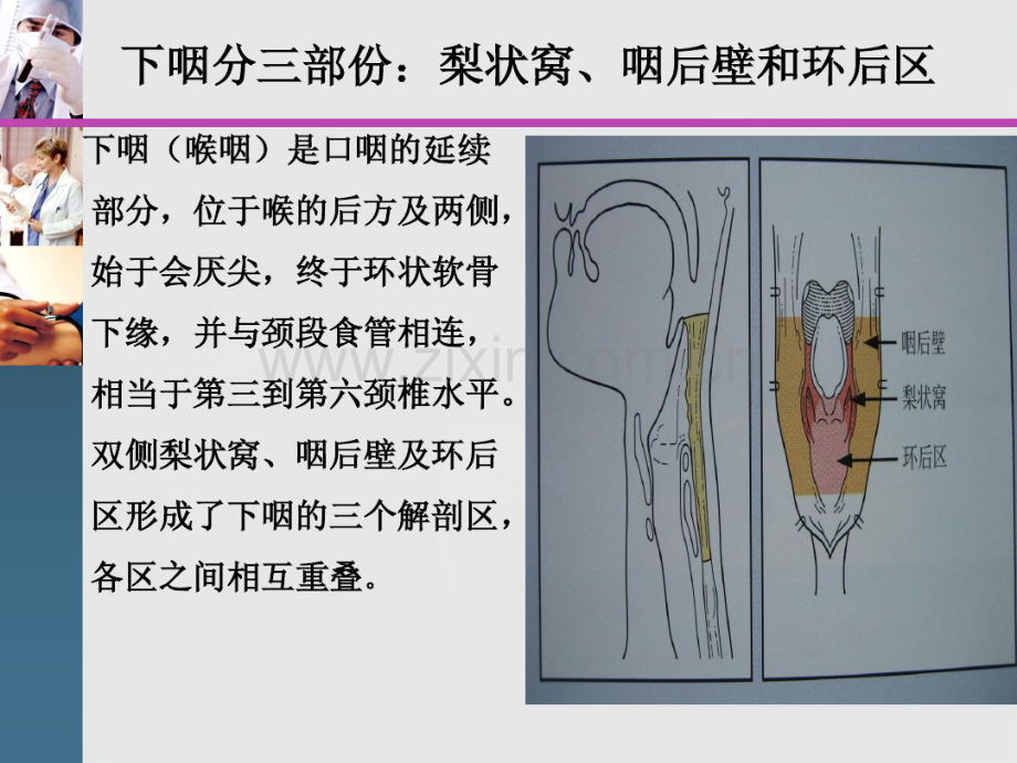 下咽癌护理查房2013.pdf_第3页