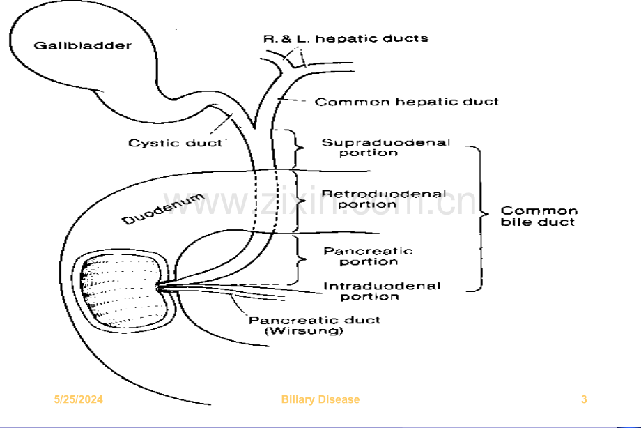 胆道疾病课件(ppt文档).ppt_第3页