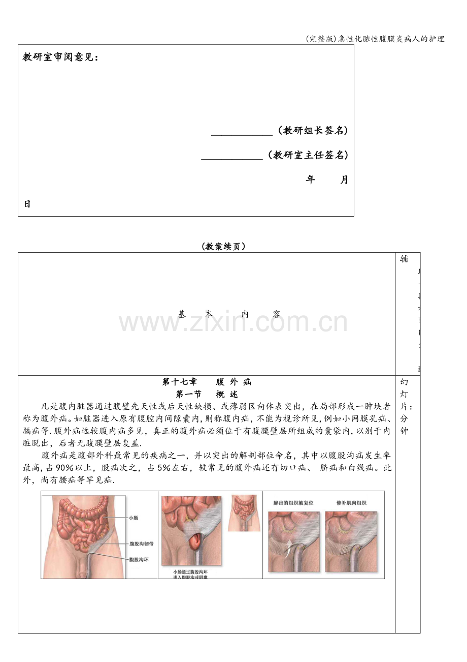 急性化脓性腹膜炎病人的护理.doc_第2页