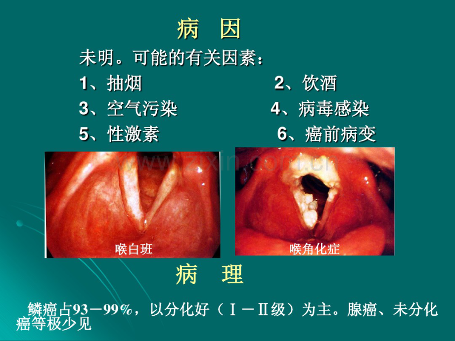 喉癌的护理.pdf_第3页