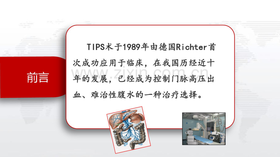 TIPS护理查房.pdf_第2页