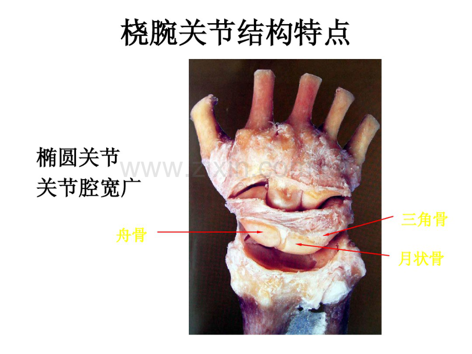 尺骨茎突骨折治疗的探讨.pdf_第3页