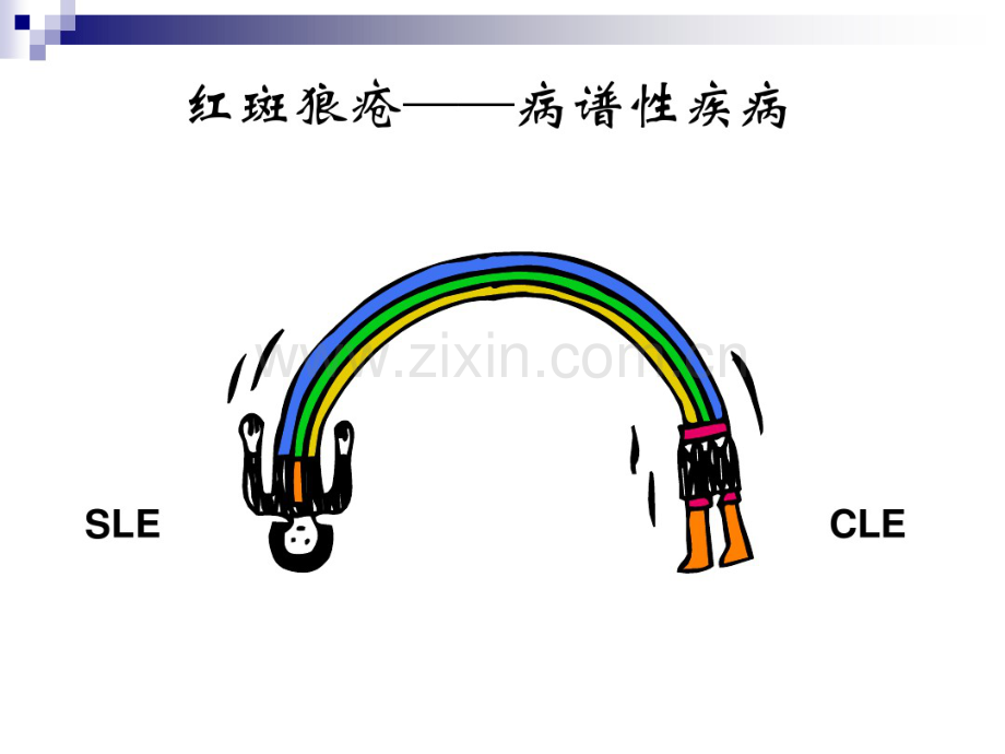 SLE临床研究进展.pdf_第3页