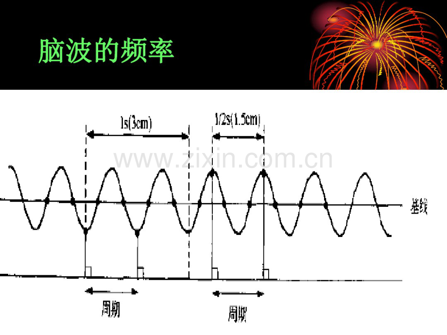 脑电图判读-(2).pdf_第3页