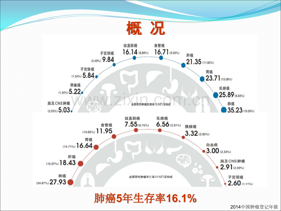 肺癌分子靶向药物治疗病例分享.ppt_第2页