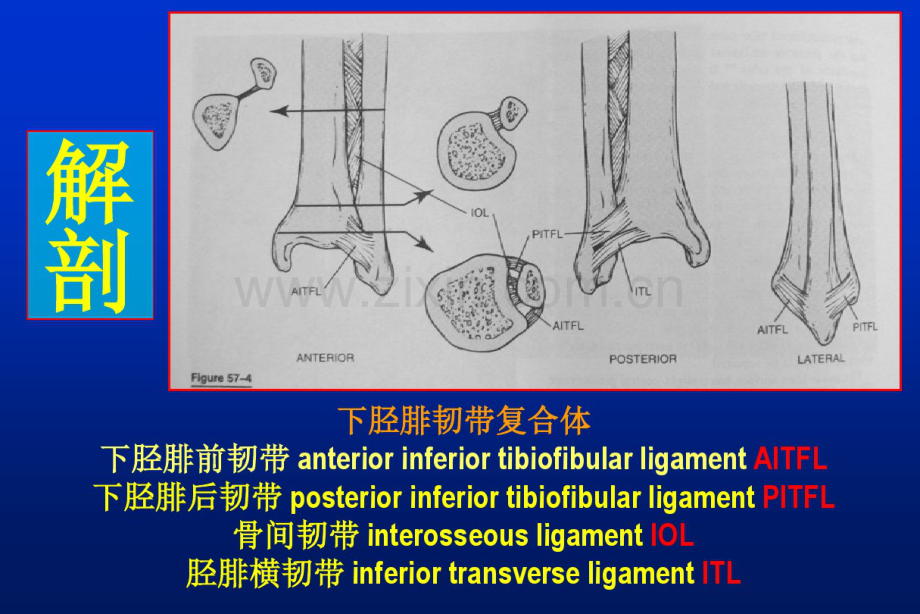 下胫腓联合损伤的诊治.pdf_第3页