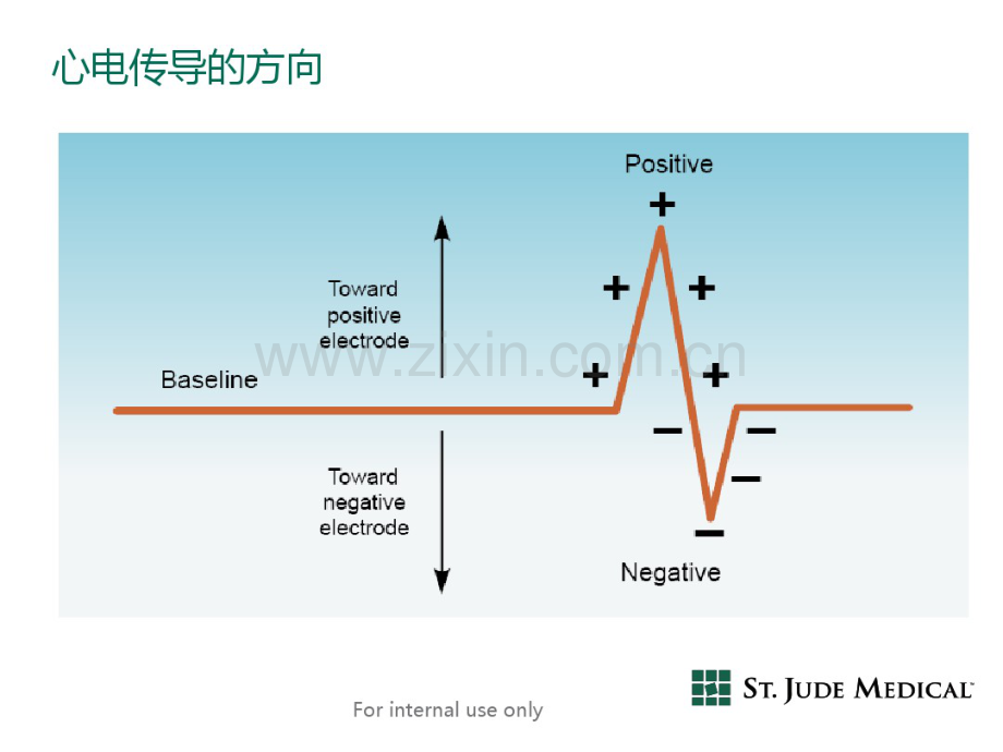 RVOT解剖与体表图.pdf_第3页