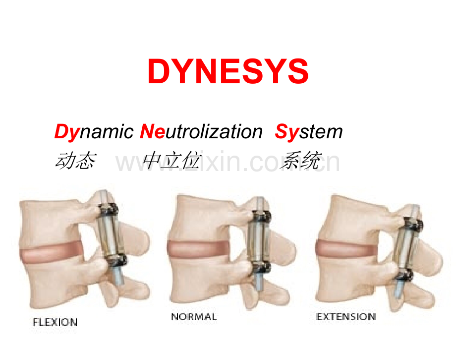 腰椎非融合固定——Dynesys(ppt文档).ppt_第2页