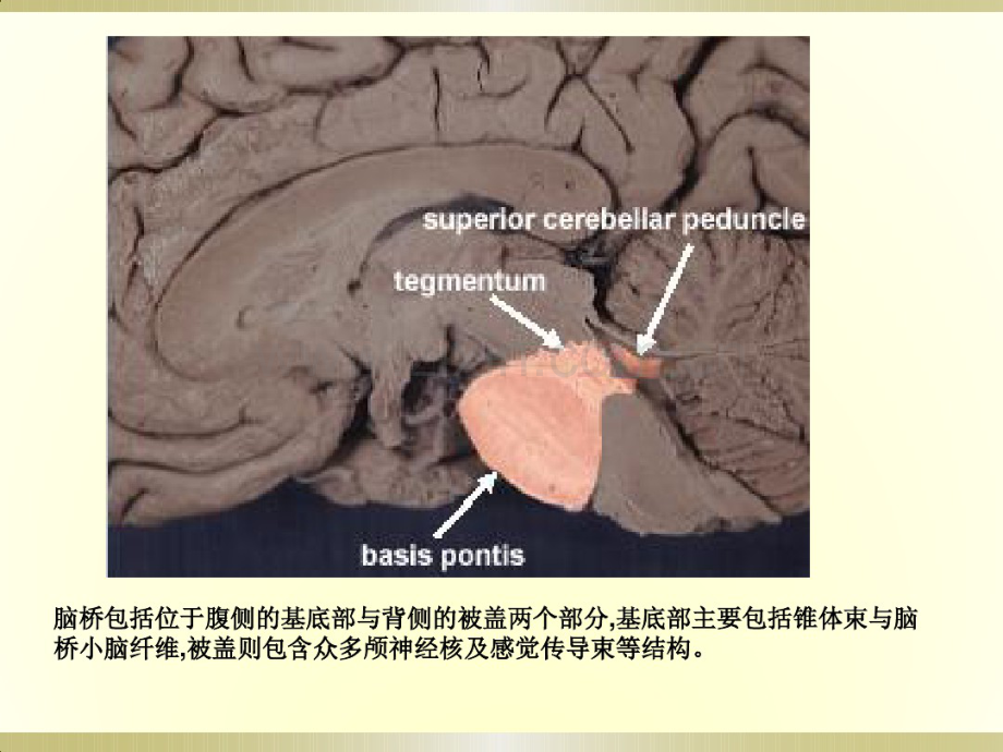 脑桥病变定性诊断与影像学特点(20190912214721).pdf_第2页